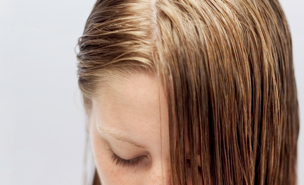 oily-greasy-scalp.jpg
