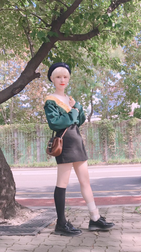 다이아 예빈 발목 부상_20170929.jpg